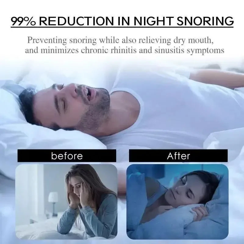 Sleep & Snoring Mouth Tape Gentle Skin-Friendly Adhesive - Omega Lifestyles