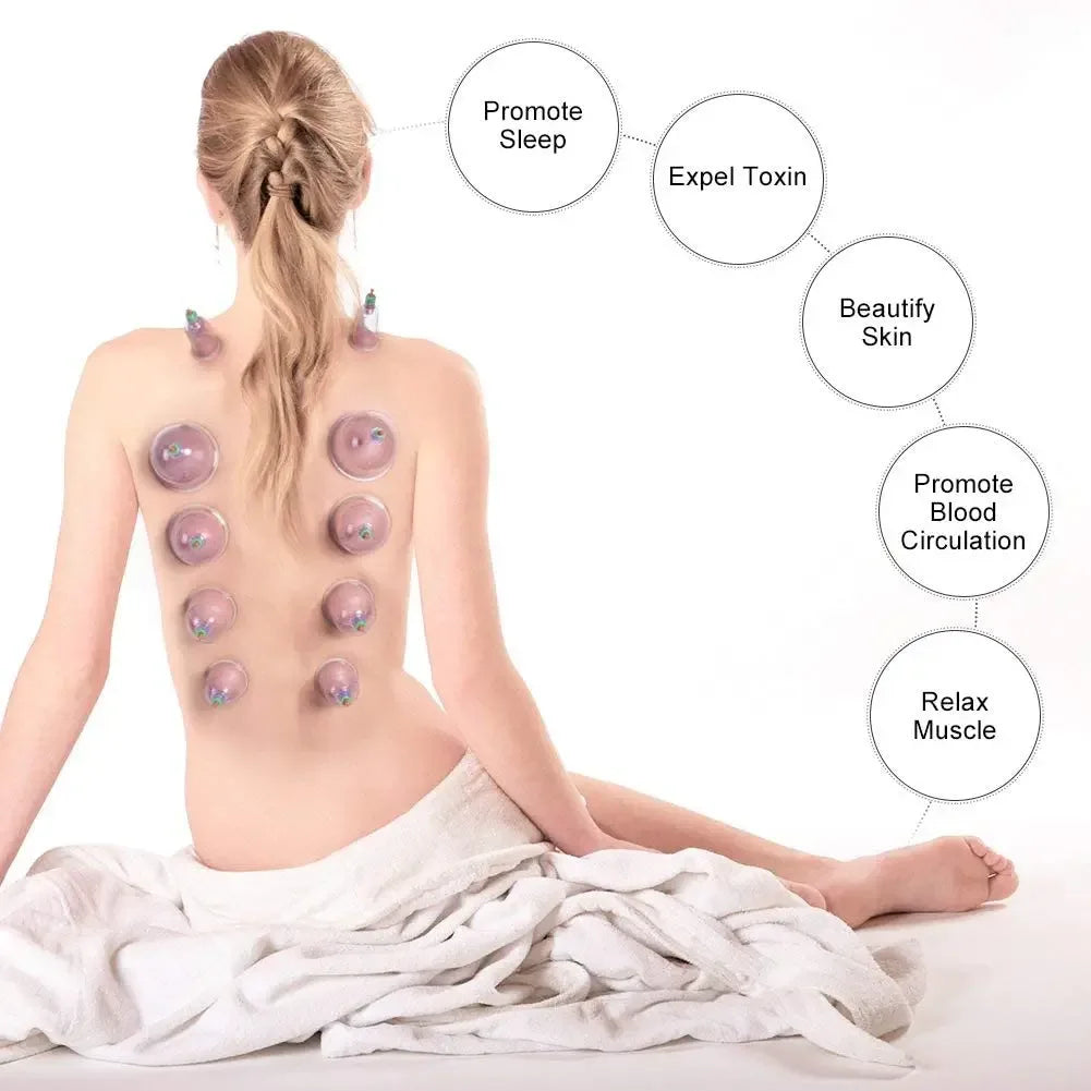 12-Piece Vacuum Cupping Therapy Set With Pump - Omega Lifestyles