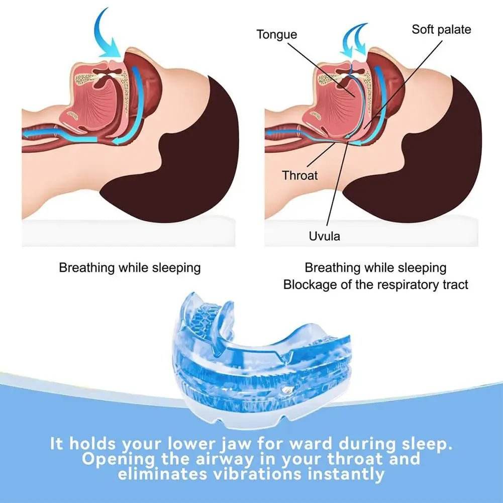 Adjustable Comfortable Anti-Snoring Mouth Guard Appliance - Sleep Galleria
