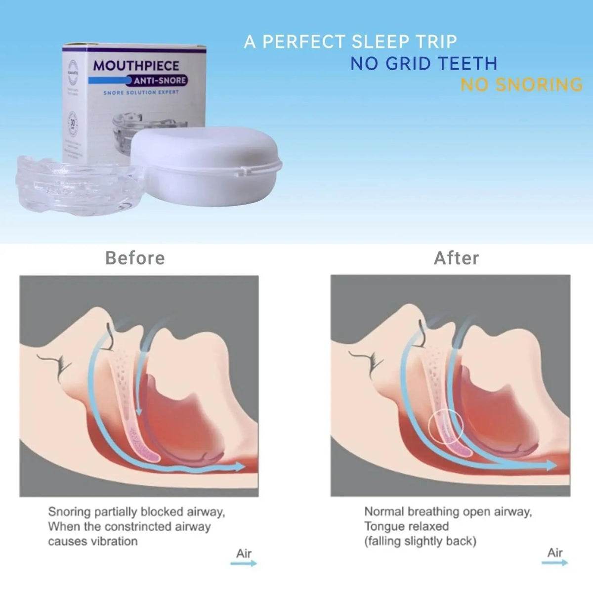 Adjustable Transparent Anti Snore Mouth Guard - Sleep Galleria