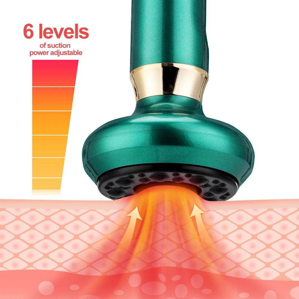 Intelligent Rechargeable Electric Cupping Massage Device - Sleep Galleria