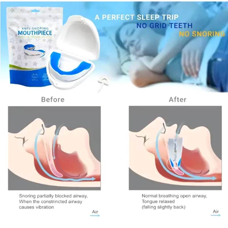 Mouthpiece Anti Snore Mouth Guard Silicone Anti Snoring Bruxism Sleeping Aid Apnea Guard Teeth Snoring Device Stop Snore Oral - Sleep Galleria
