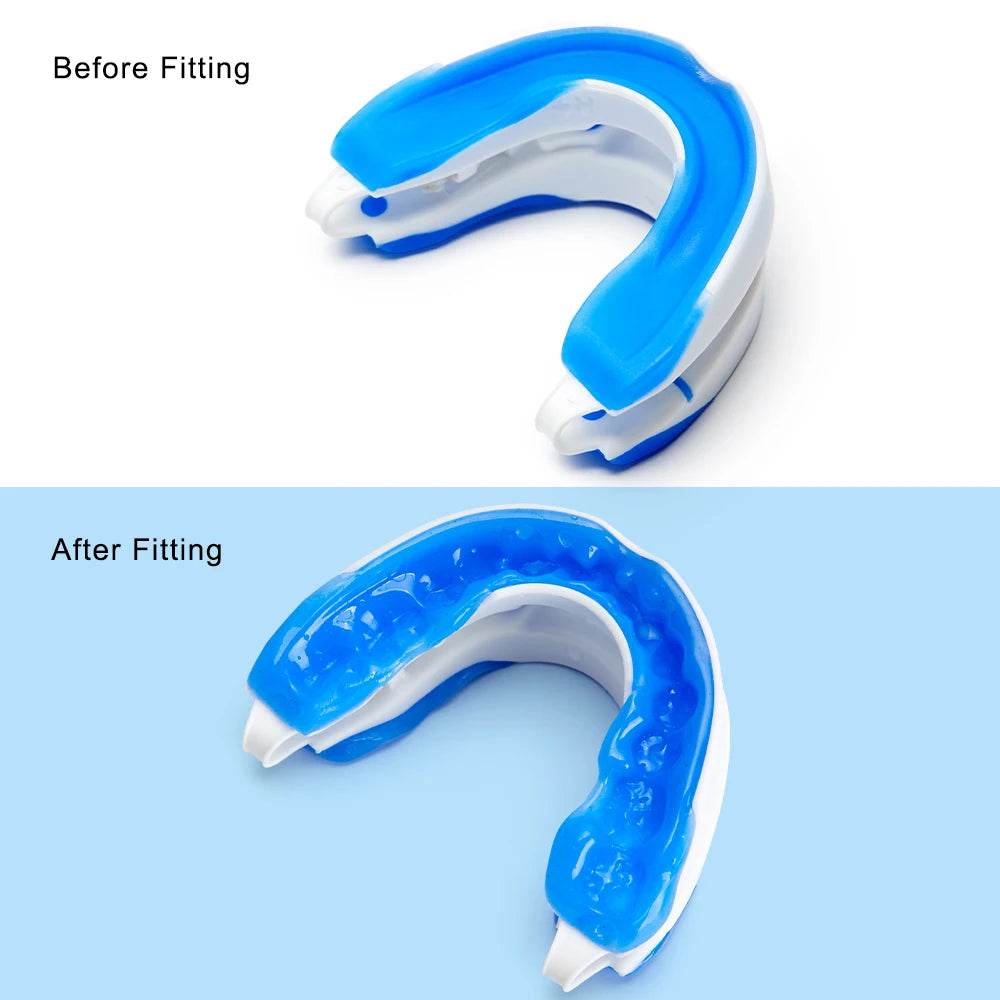 Mouthpiece Anti Snore Mouth Guard Silicone Anti Snoring Bruxism Sleeping Aid Apnea Guard Teeth Snoring Device Stop Snore Oral - Sleep Galleria