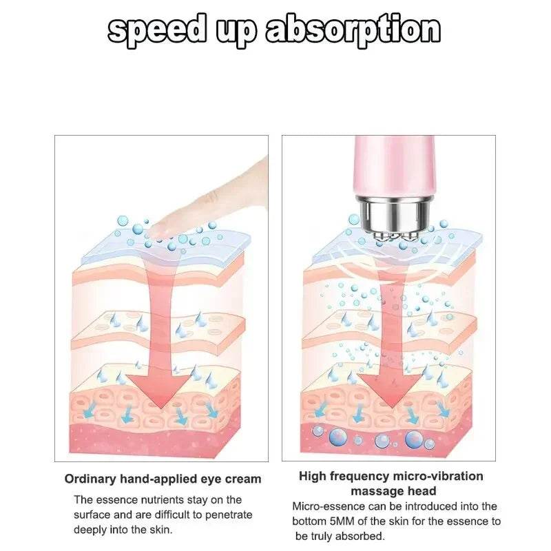 Electric Eye Massager For Dark Circles And Puffiness - Sleep Galleria