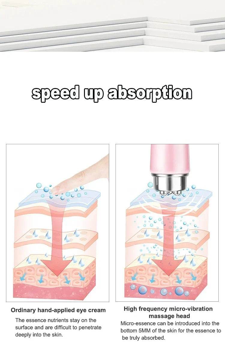 Electric Eye Massager For Dark Circles And Puffiness - Sleep Galleria