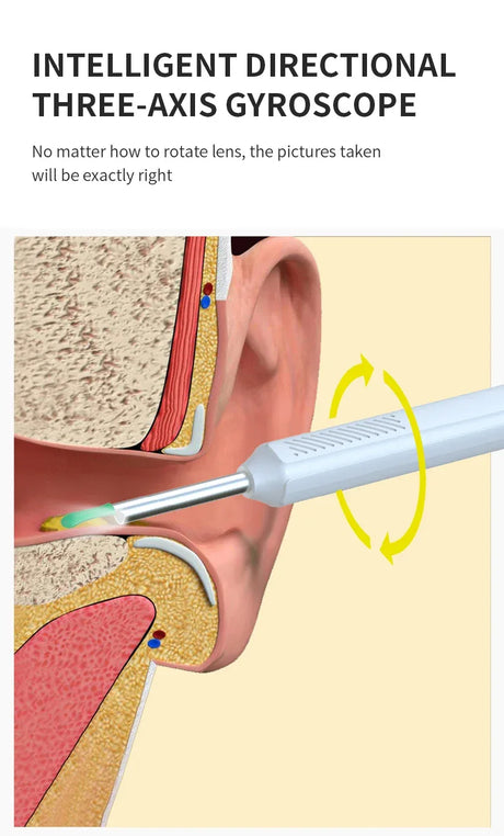 Wireless Visual Ear Cleaner With Camera Endoscope Tool - Omega Lifestyles