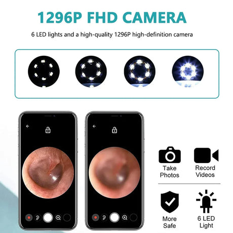 High Precision Visual Ear Cleaner With LED Light - Omega Lifestyles