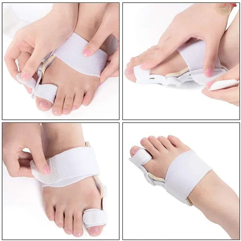 Pair Of Hallux Valgus Toe Bunion Corrector Splint - Omega Lifestyles