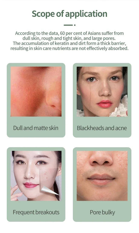 Deep Vibrate Ultrasonic Facial Skin Scrubber Cleaner - Omega Lifestyles