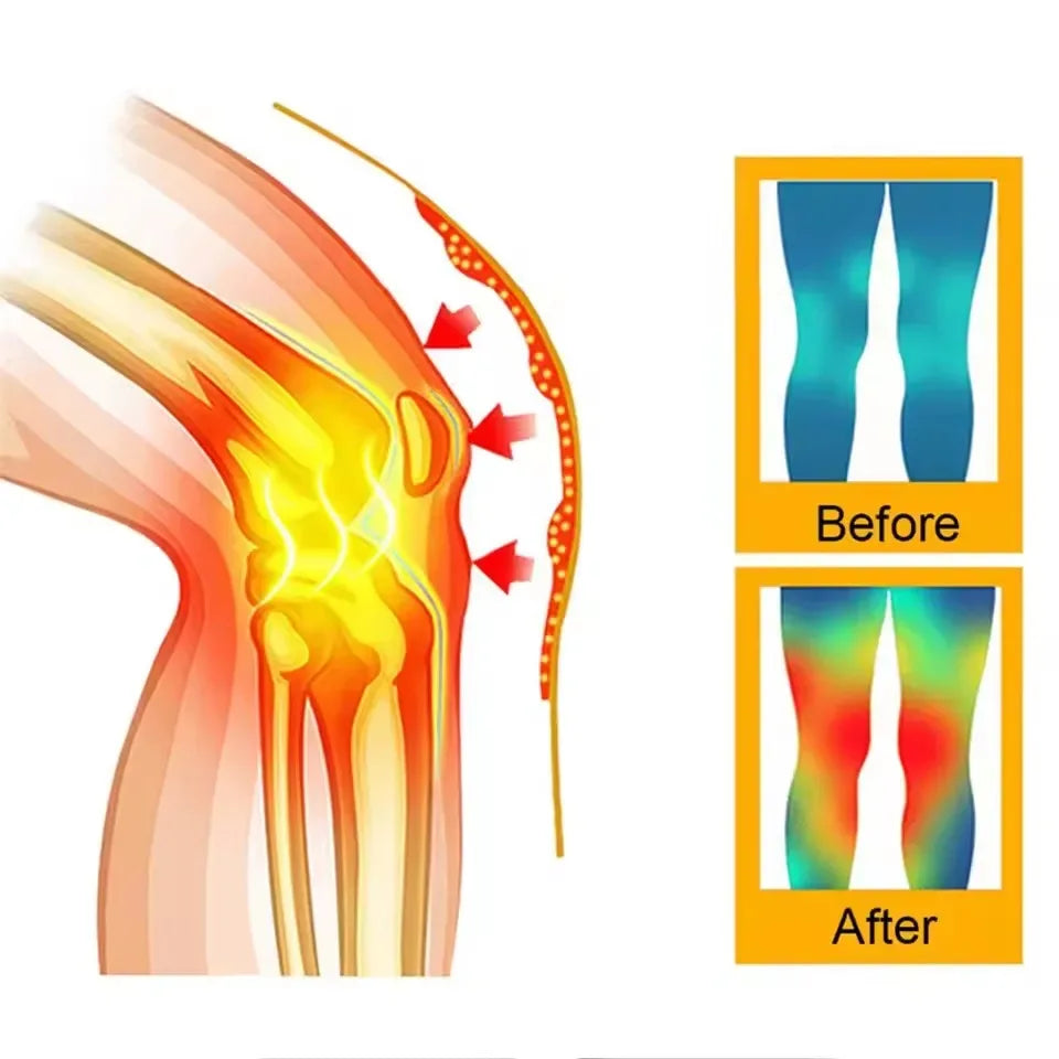 Electric Calf Heating Massager With Mugwort Compress - Omega Lifestyles