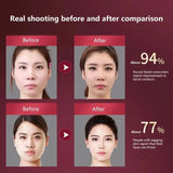 LED Photon Therapy Facial Slimming Vibration Massager - Omega Lifestyles