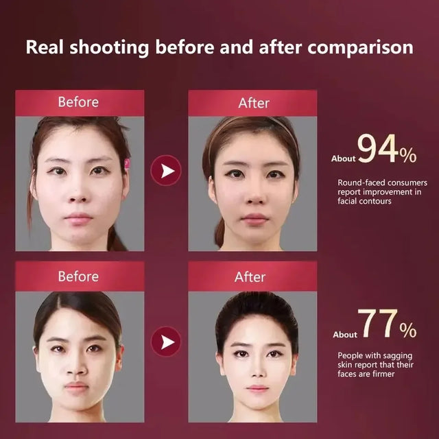 LED Photon Therapy Facial Slimming Vibration Massager - Omega Lifestyles