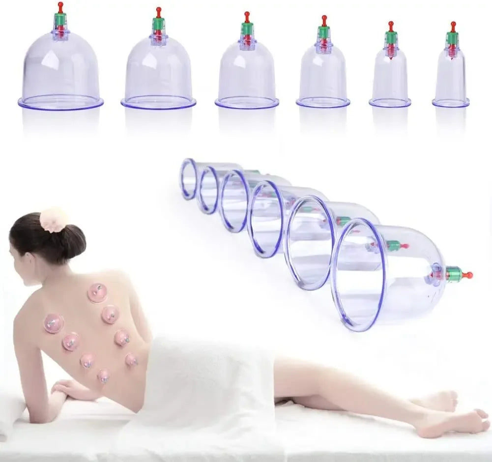 12-Piece Vacuum Cupping Therapy Set With Pump - Omega Lifestyles