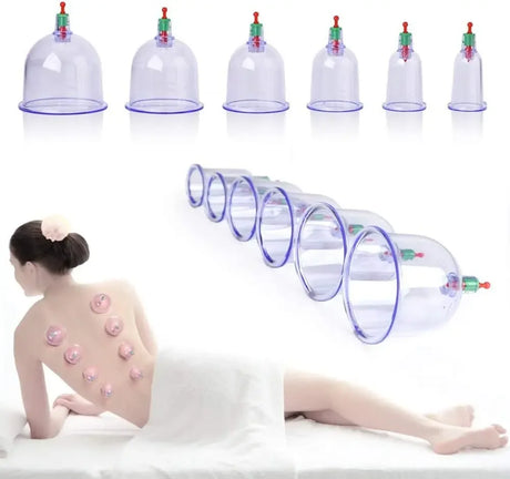 12-Piece Vacuum Cupping Therapy Set With Pump - Omega Lifestyles
