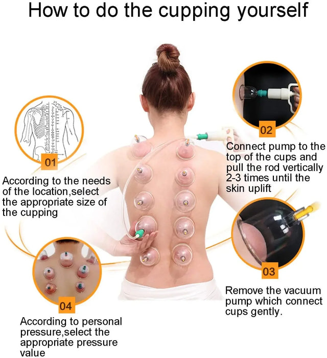 12-Piece Vacuum Cupping Therapy Set With Pump - Omega Lifestyles