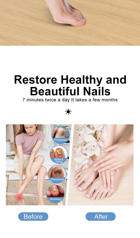 Rechargeable Nail Phototherapy Lamp UV Foot Care Tool - Omega Lifestyles