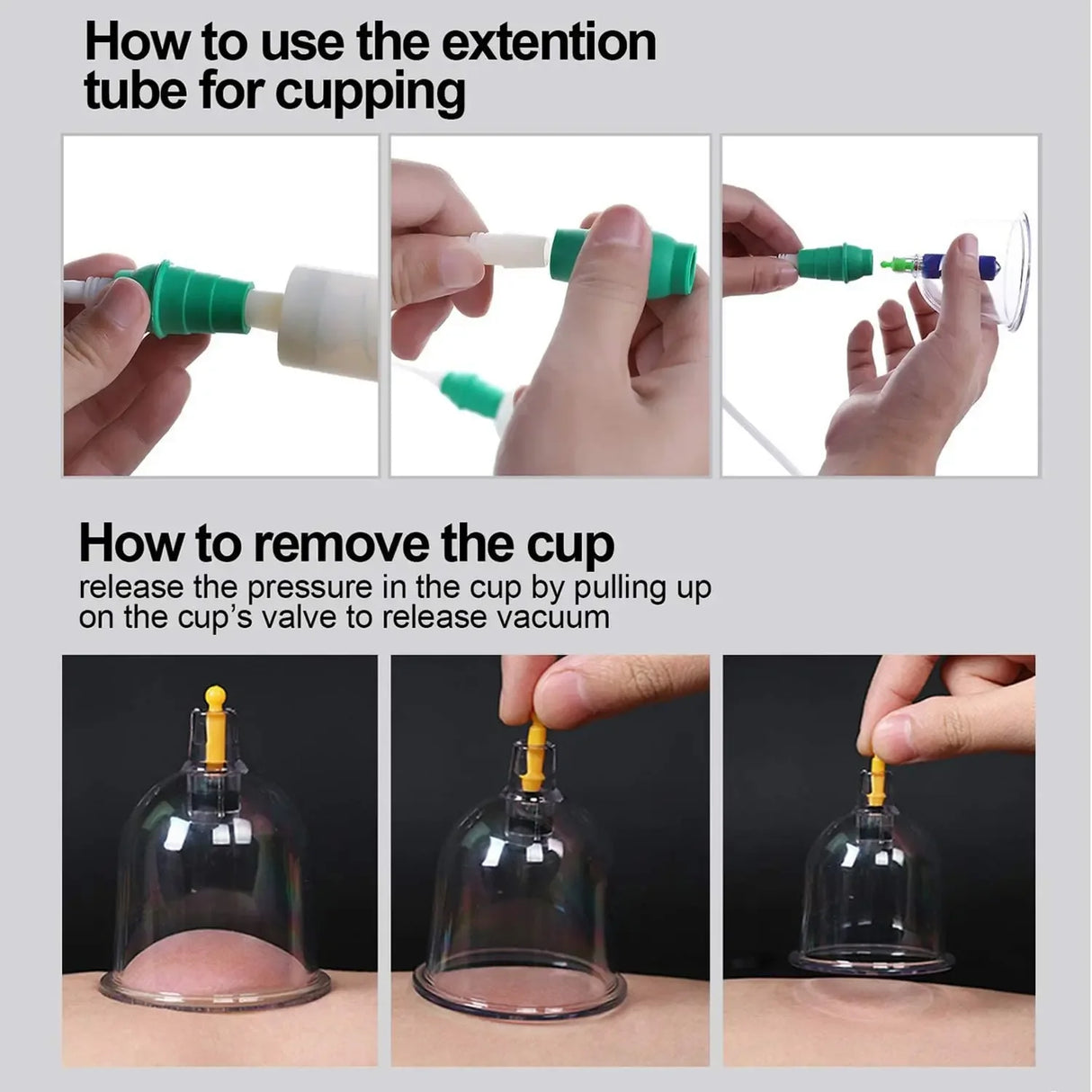 12-Piece Vacuum Cupping Therapy Set With Pump - Omega Lifestyles