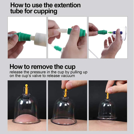 12-Piece Vacuum Cupping Therapy Set With Pump - Omega Lifestyles