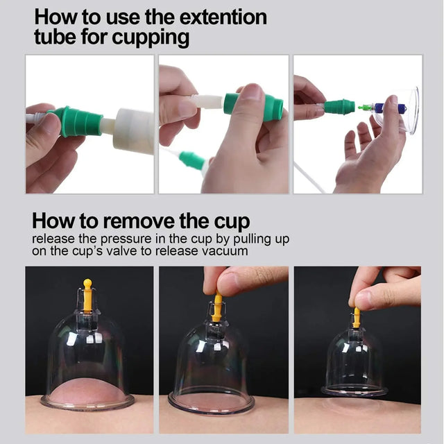 12-Piece Vacuum Cupping Therapy Set With Pump - Omega Lifestyles