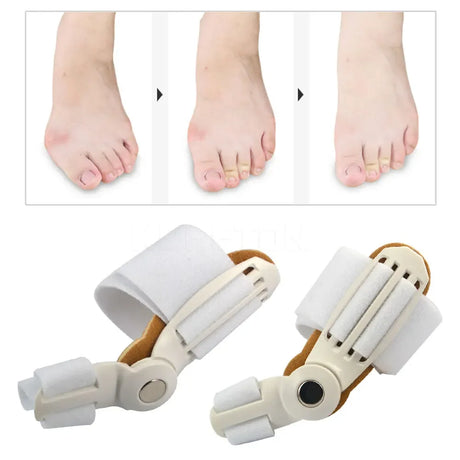 Pair Hallux Valgus Bunion Corrector Big Toe Straightener - Omega Lifestyles