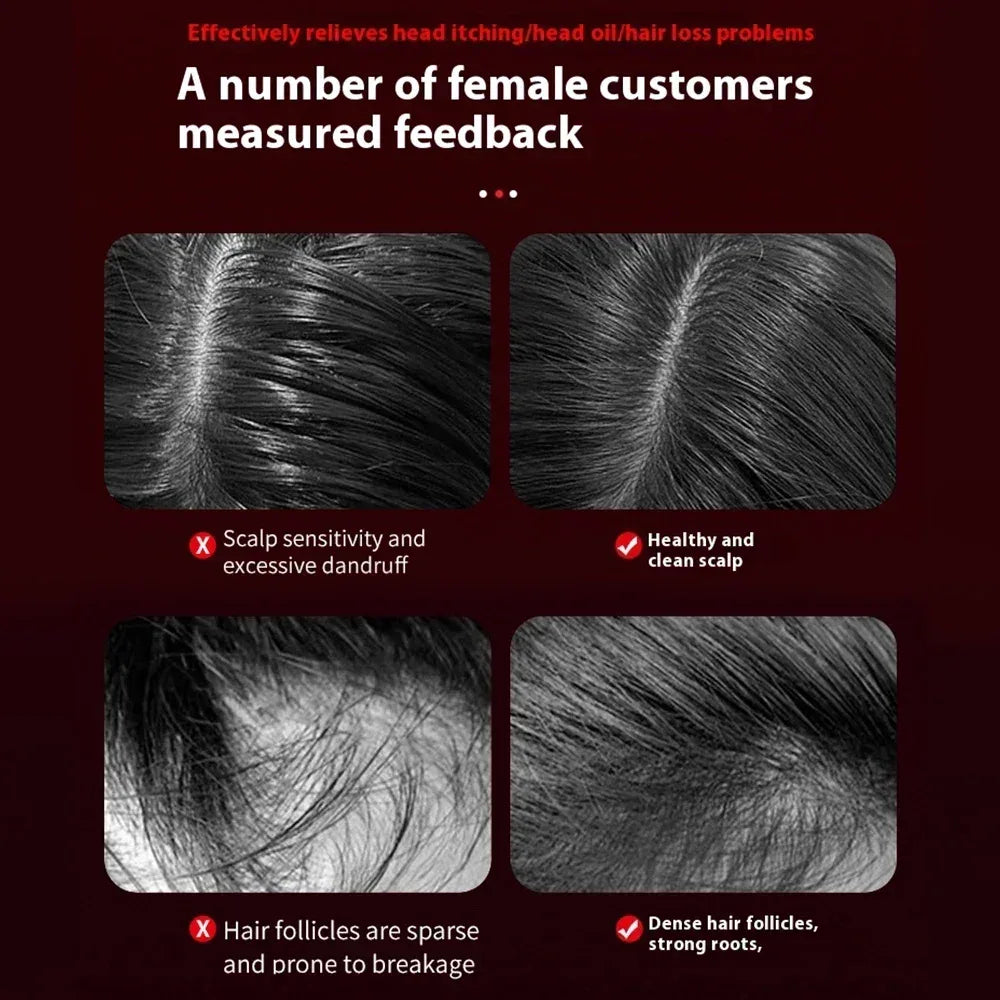 Infrared Light Scalp Massage Comb With Hair Growth Therapy - Omega Lifestyles