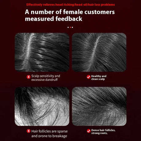 Infrared Light Scalp Massage Comb With Hair Growth Therapy - Omega Lifestyles