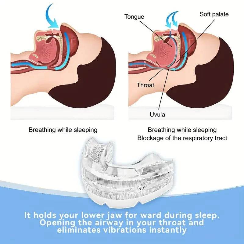 Anti Snoring Oral Protective Gear Bruxism Mouth Guard Adjustable Suitable for Bruxism and Sleep Apnea Snoring Cessation Device - Omega Lifestyles