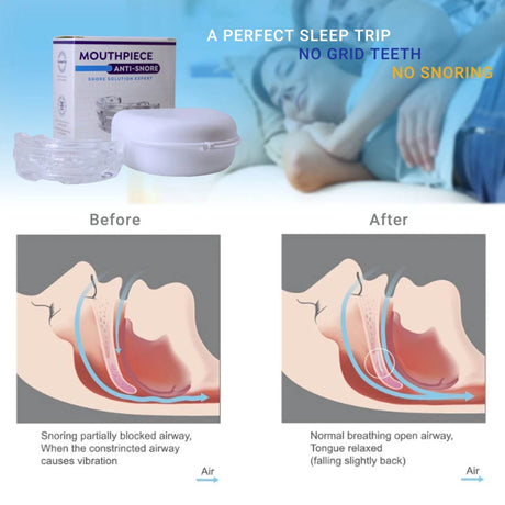 Mouthpiece Anti Snore Mouth Guard Silicone Anti Snoring Bruxism Sleeping Aid Apnea Guard Teeth Snoring Device Stop Snore Oral - Sleep Galleria